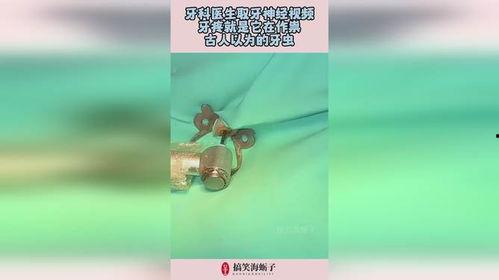 取牙视频,直观视频带你了解每一步