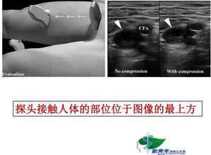 皮肤病讲座视频,讲座视频精华概述